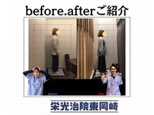 栄光治院 整体院東岡崎/岡崎整体/肩こり/猫背矯正/姿勢
