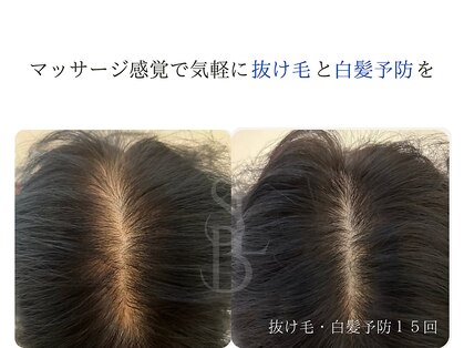 サナビューティーリア(sanaBeauty Lia)の写真