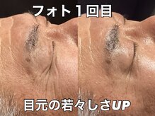 リエル(RIEL)/【フォト】