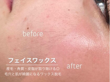 ハリウッドブロウリフト ワクシー 蒲田店(HOLLYWOOD BROW LIFT WAXYYY.)の写真