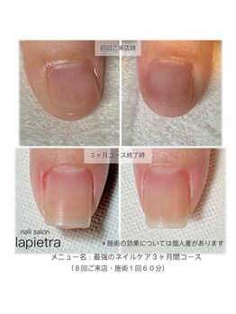 ネイルサロン ラピエトラ(la pietra)/最強のネイルケア3ケ月間コース
