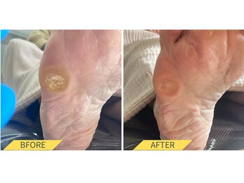 ふっとけ庵/たこケア