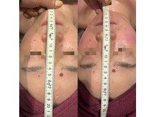 ラルーナ(LA LUNA)の雰囲気（一度で-３cmの小顔コルギ♪小顔で可愛らしく若々しい印象に♪）