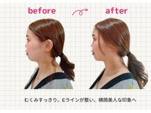 ナチュラルハリー(NaturalHarry)の雰囲気（むくみ顔を卒業して横顔美人を目指す方に！別人級の変化！！）