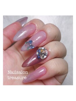 トレジャー(treasure)/