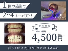 ココロビューティーギャラリー 武蔵小杉(cocorobeauty gallery)の雰囲気（1日8分×2～6照射可能◎当日効果を実感できます！）