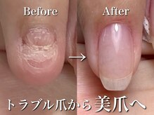 リリー/爪がこんなに大きく成長！