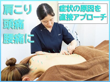 リケア道玄坂鍼灸院 渋谷(reCare)の写真