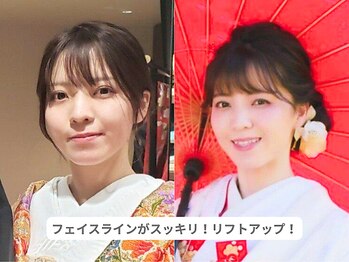 ピュアノア 三木店/ブライダルエステ　三木小野西脇