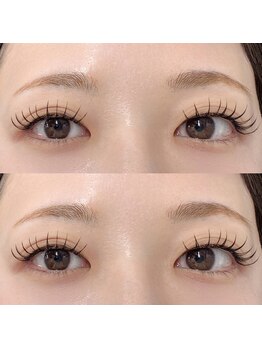 ジェネシス(Genesis)/フラットラッシュ