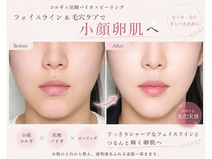 ライゼ(REISE)の写真