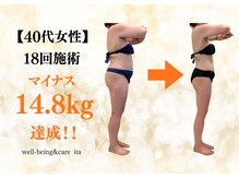 イタ 岡崎店(ita)の雰囲気(【マイナス14.8kg達成】結果が出る当店人気No.1の"インド式痩身")