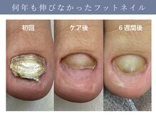 イデアル(ide’al)/足のトラブル爪も対応◎