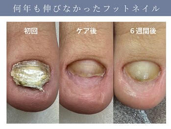 イデアル(ide’al)/足のトラブル爪も対応◎