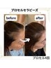 \初回限定¥15,000オフ/【育毛促進】プロセルセラピーズ初回体験
