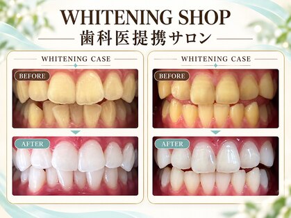 ホワイトニングショップ上越店の写真