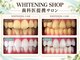 ホワイトニングショップ上越店の写真