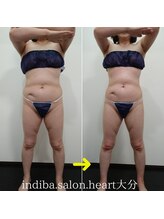 ハート 大分(heart)/3時間VIP専用インディバボディ