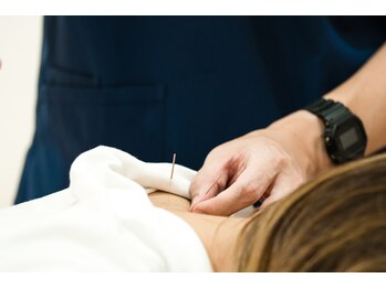 たたら鍼灸整骨院/鍼施術