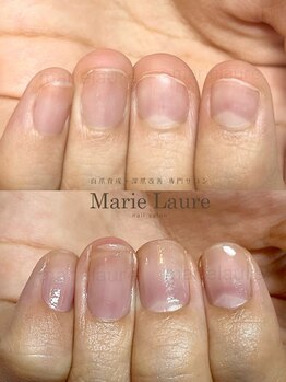 マリーロール 淀屋橋本店(Marie Laure)/自爪育成/深爪矯正/ネイルケア