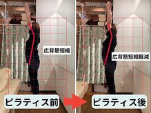 ファクト(fact)/慢性的な首肩こりや頭痛でお悩み