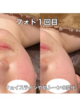 リエル(RIEL)/【フォト】