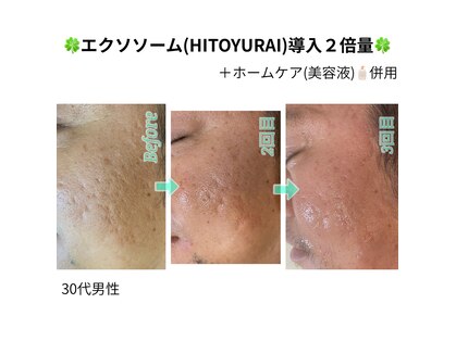 メリナ(Melina)の写真