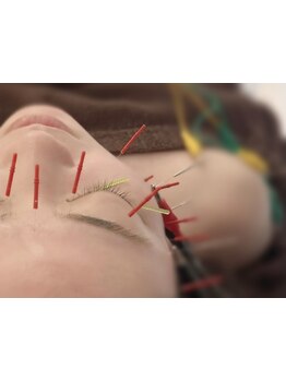 眼精疲労を解消したい