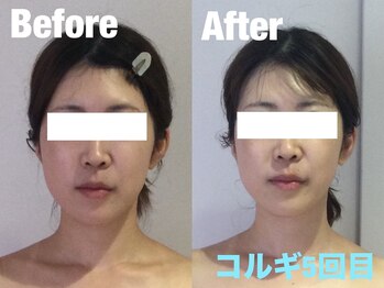 ビーキュート 学芸大学店(BE-CUTE)/コルギ2回施術 30代