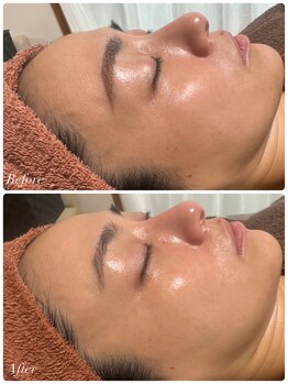 シャナ(Shana)/ラミネーションピール