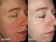 リアルナ(REALUNA)/