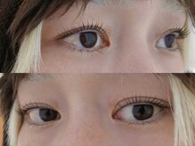 ネストアイ(NEST eye)