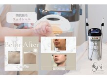 ソイビューティー(Soi beauty)の雰囲気（寝られるくらい痛みの少ない最新美肌脱毛♪美容成分でつるん肌に）