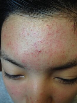 アイエステ(Ai esthe)/