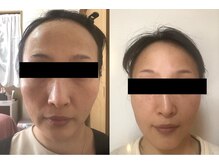 ビューティーシェアハウス まつ毛エクステ レイ/