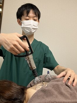 仁接骨院 じん鍼灸治療院/カッピング施術風景