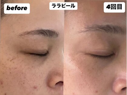 ヘアファッション ユミ(HAIR FASHION YUMI)の写真