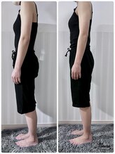 アイナ(aina)/猫背、巻き肩もお任せ！骨盤矯正