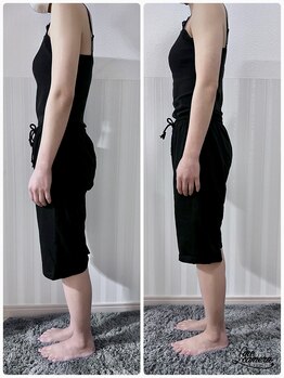 アイナ(aina)/猫背、巻き肩もお任せ！骨盤矯正