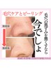 ピーリングだけどお肌に優しく剥離なし★水素で角質も吸引ツヤ肌へ16,500円→