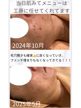 パルティノ 高崎店/症例