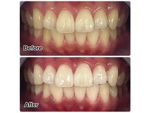 べっぴん脱毛×なないろ美人 鈴鹿店の雰囲気(【ホワイトニング5回】人と関わることが多い方におすすめ♪)