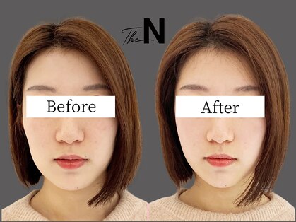 ザ エヌ(The N)の写真