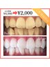 【☆大人気スタンダード☆】40分照射¥6,980→¥2,000