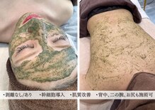 ラニサロン(Lanisalon.)