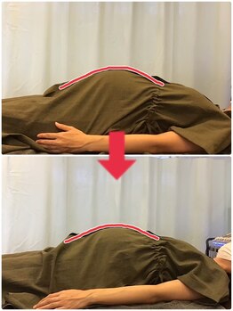 ここてら 浜松佐鳴台院/妊娠中の不快症状改善にも◎