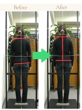 かとう整骨院/ビフォーアフター（全身矯正）