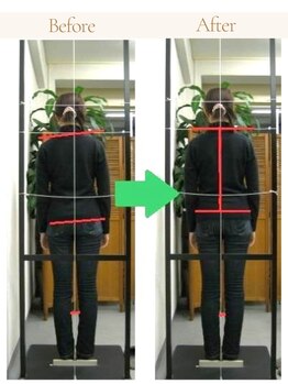 かとう整骨院/ビフォーアフター（全身矯正）