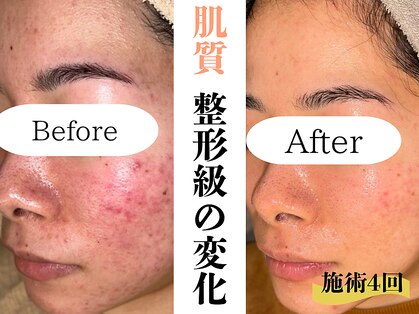 ハル(HARU.)の写真