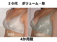 バストサロン メルベイユ(Merveile)/デコルテ～ボリュームUP/形整う